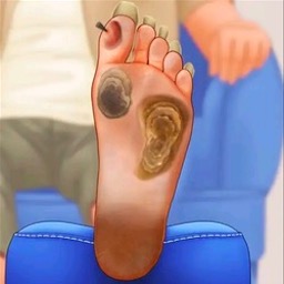 修脚足疔模拟器去更新版