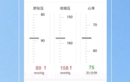 Kiwi血压管理助手v1.5.9截图