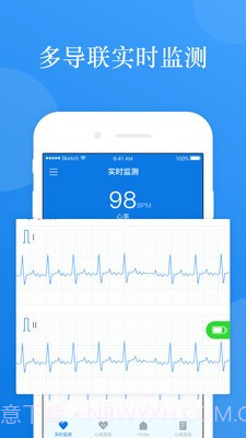AI ECG1.0.22截图