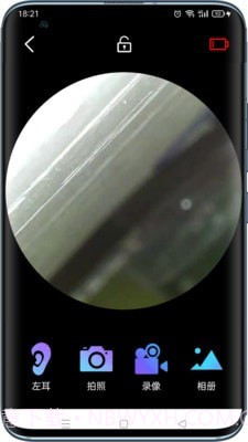 可视采耳仪截图3 可视采耳仪截图3