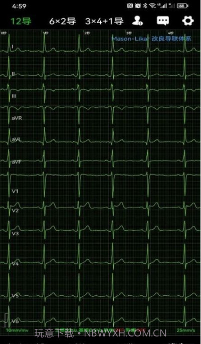 心电一张网截图4