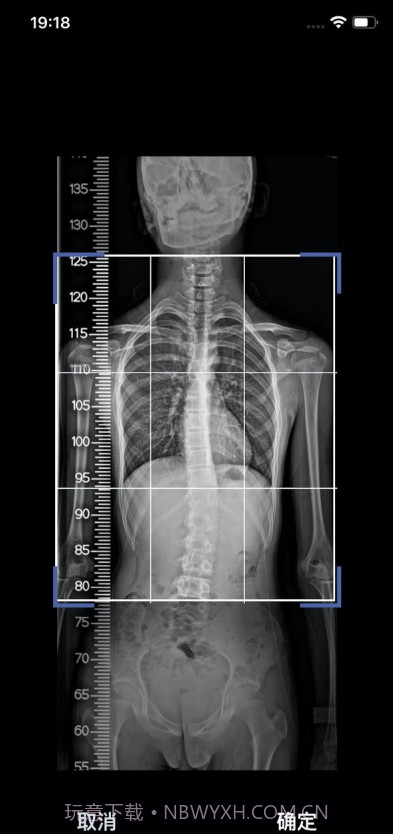 筠成矫形截图4 筠成矫形截图4