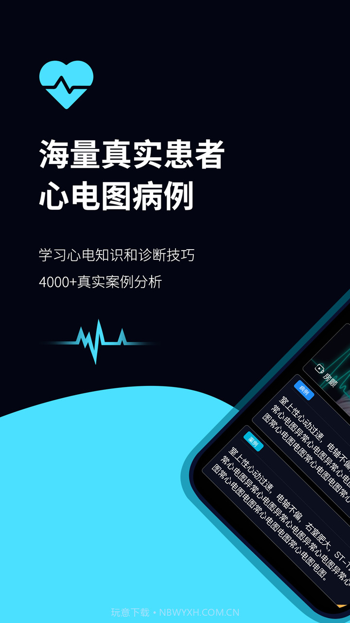 心电图ECG截图1 心电图ECG截图1