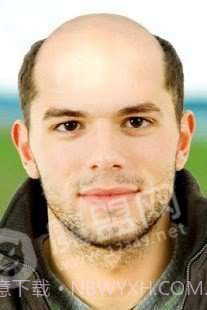 秃头生成器中文版截图3 秃头生成器中文版截图3