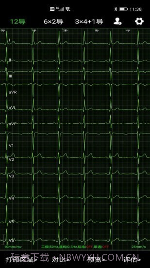 爱心电截图2 爱心电截图2