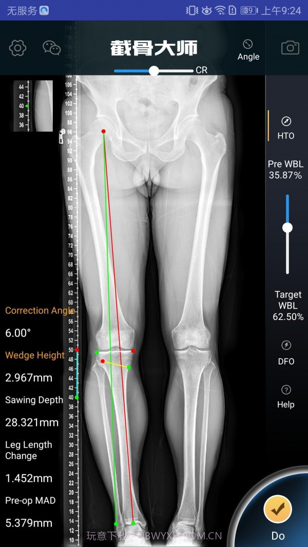 截骨大师截图2 截骨大师截图2
