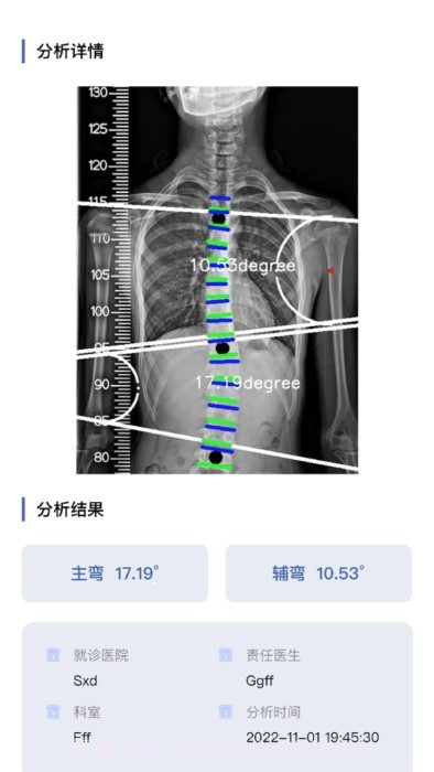 cobb角测量分析平台截图3 cobb角测量分析平台截图3