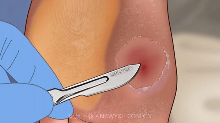 修脚足疔模拟器完整版截图3